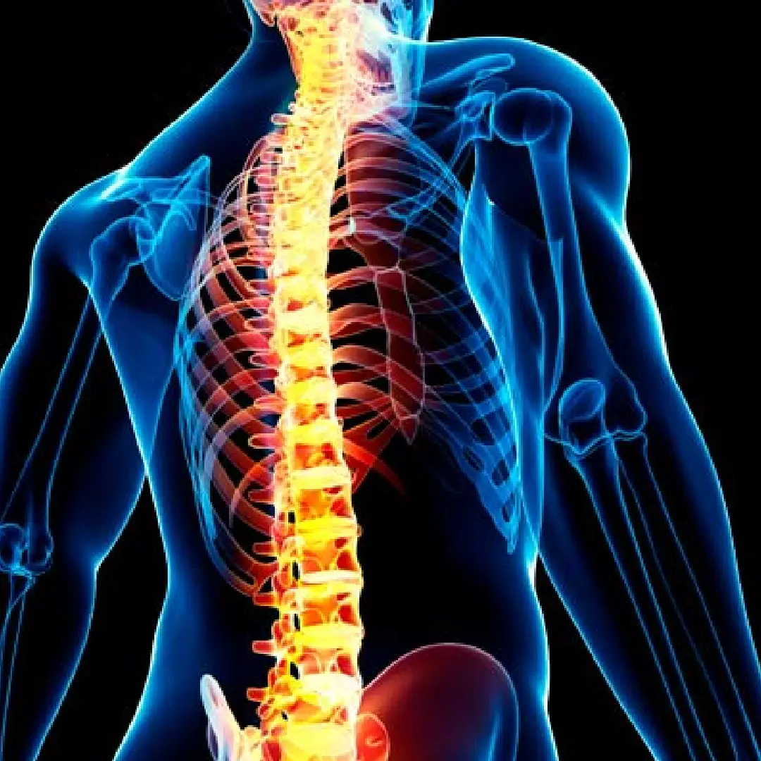 Cirugía de columna lumbar