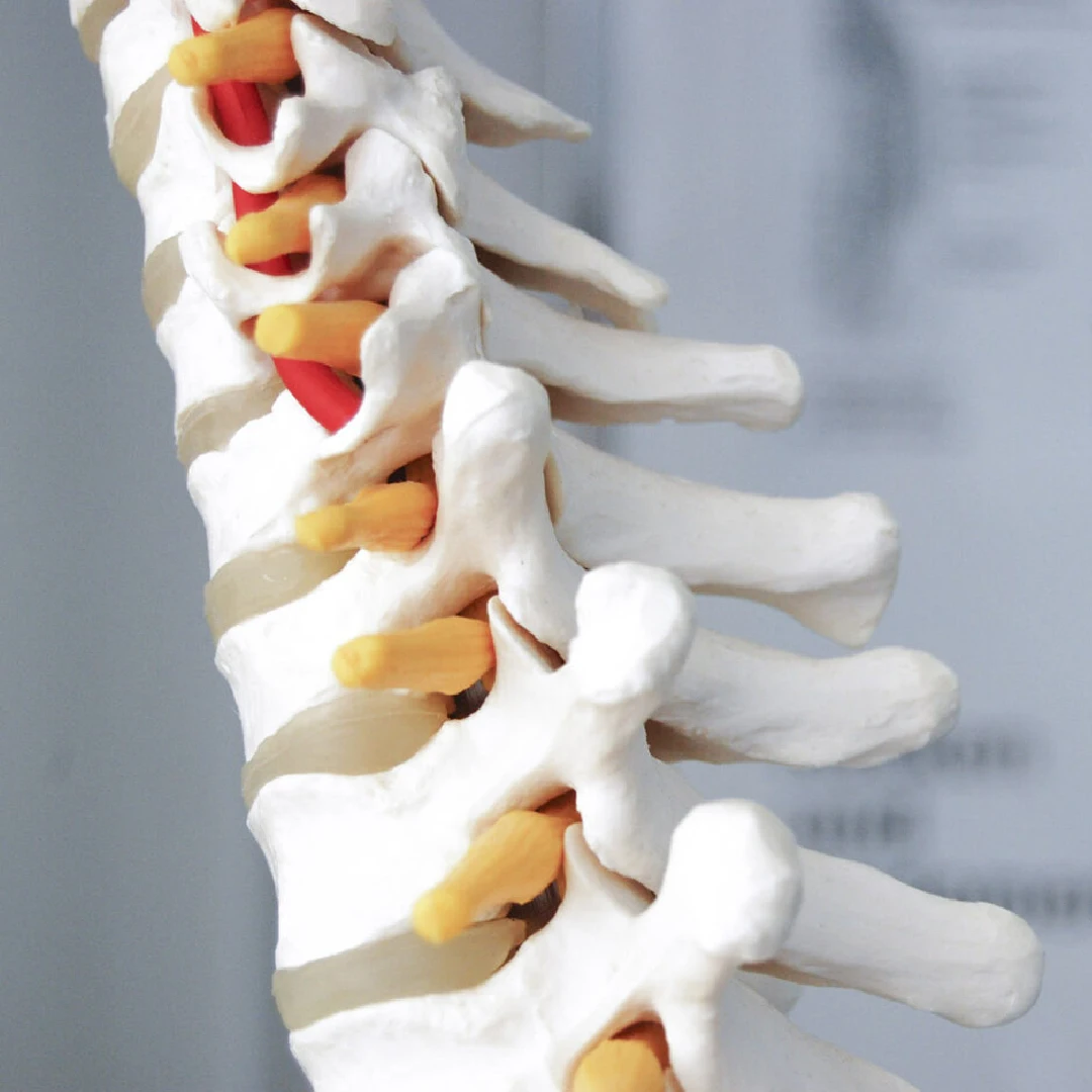Cirugía vascular cerebral